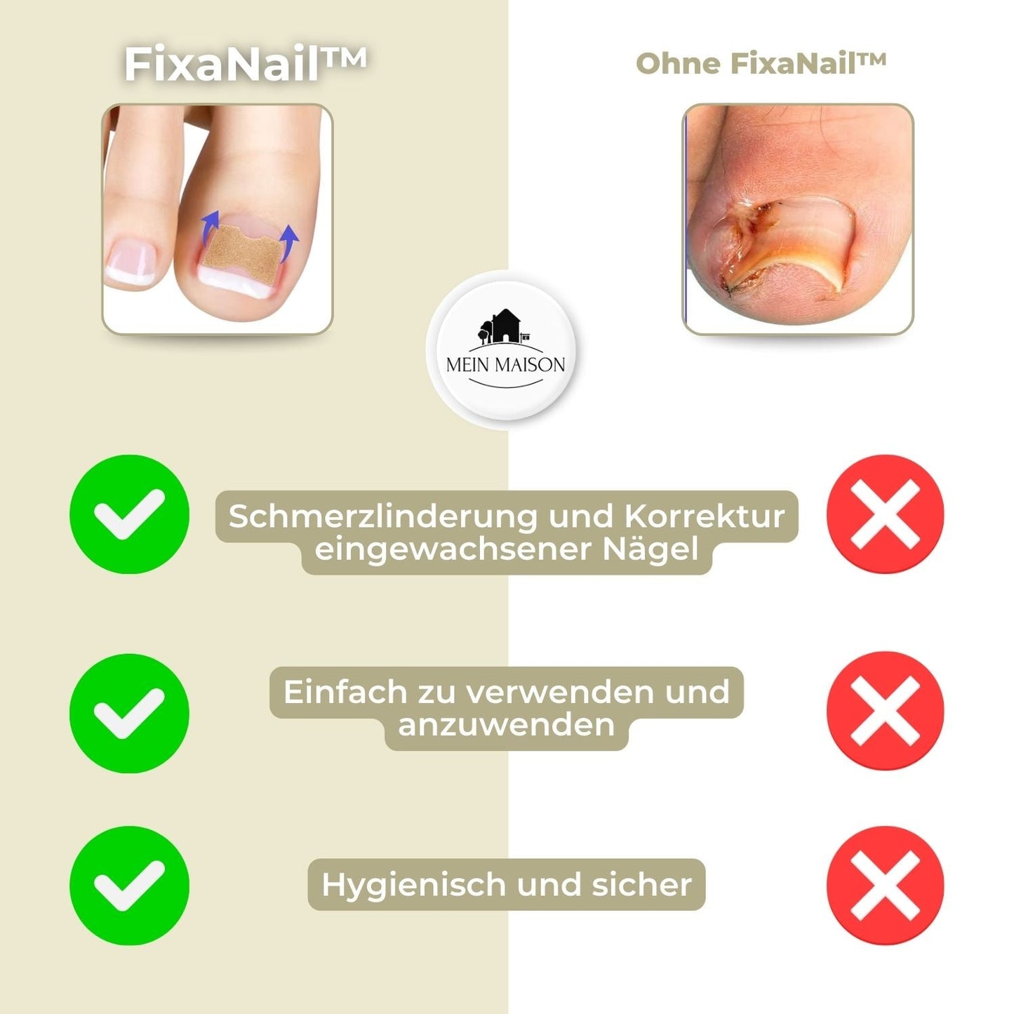 FixaNail - Correzione delicata delle unghie contro unghie incarnite e dolore