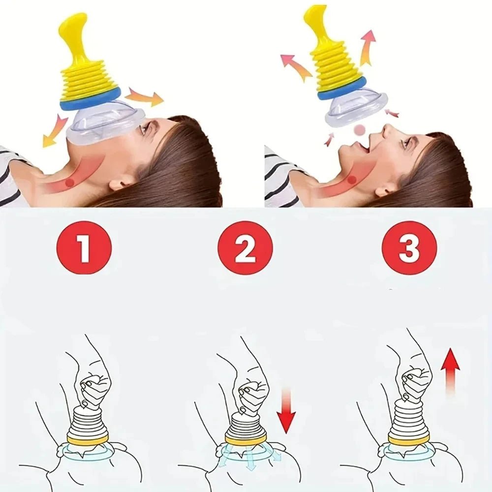 AeroGuard dispositif de sauvetage contre l'étouffement | Kit de premiers secours d'urgence contre l'étouffement pour adultes et enfants Dispositif de sécurité fiable, compact et facile à utiliser pour les cas critiques d'étouffement.