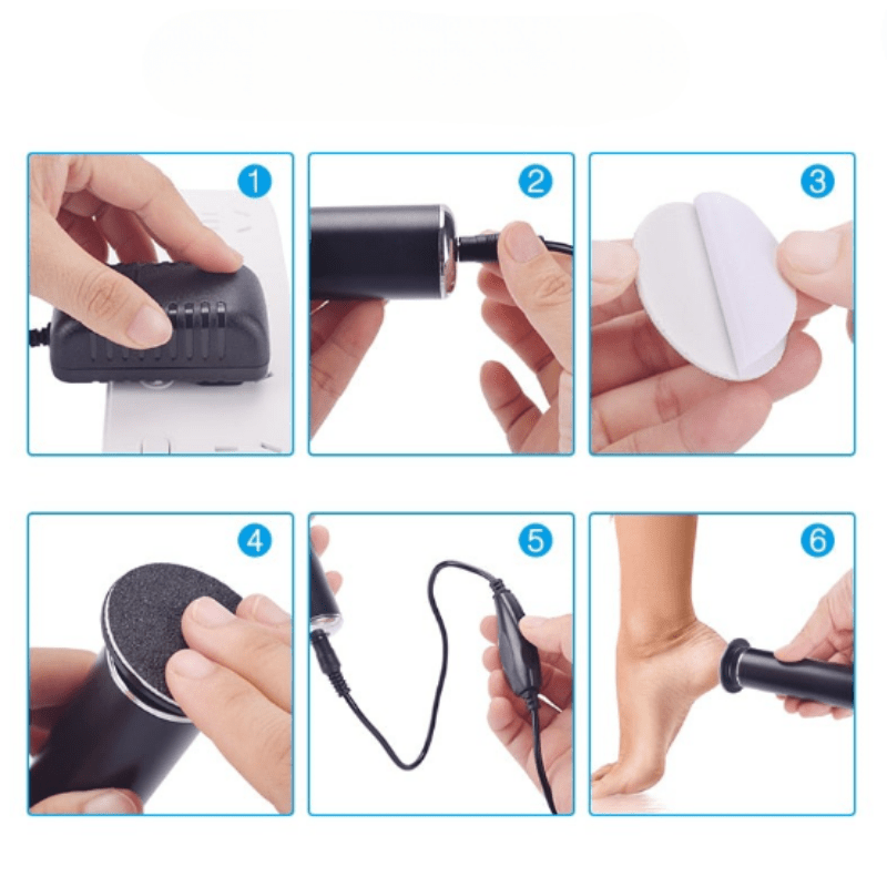 Smoothfeet – Electric pedicure file for gentle & effective foot care