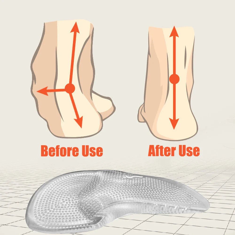 GELSTRIDE – Orthopädische Einlegesohlen aus Silikongel für ganztägigen Komfort 5