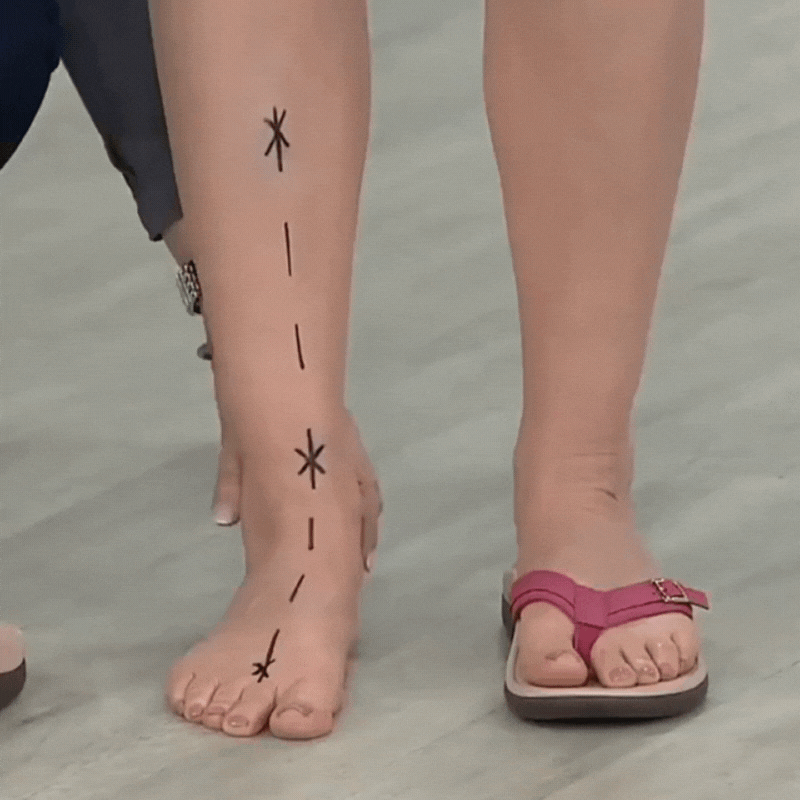 Pylomo Orthopedic Summer Sandals - Pain-free posture correction & foot support