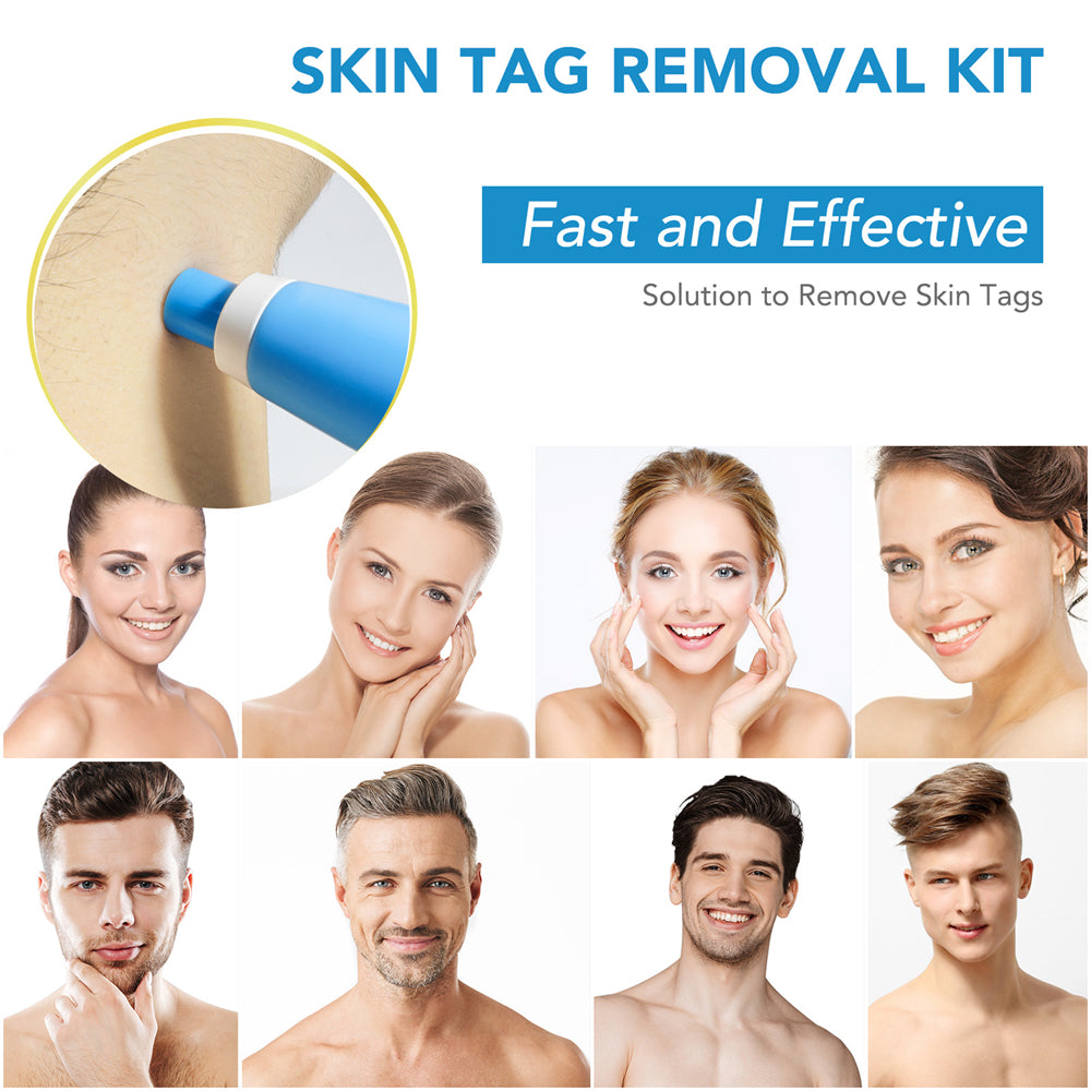 SpotOff Skin Tag Remover - Painless skin tag removal for neck, back & body