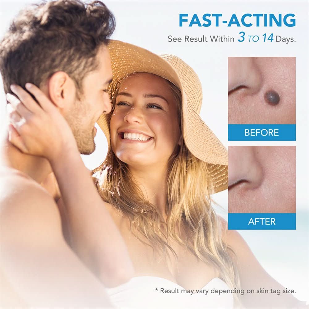 SPOTOFF - Skin spot remover for easy and targeted application to care for skin irregularities on the body
