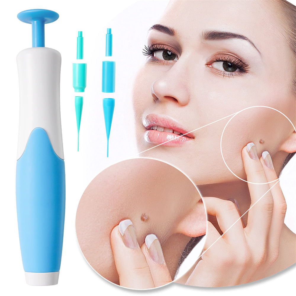SpotOff Skin Tag Remover - Painless skin tag removal for neck, back & body