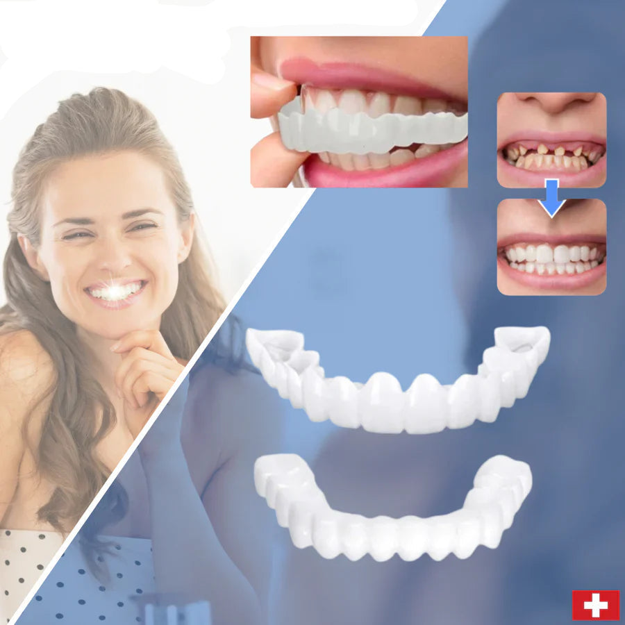 SnapFit Smile – Tandrestauratie voor een perfecte glimlach zonder bezoek aan de tandarts