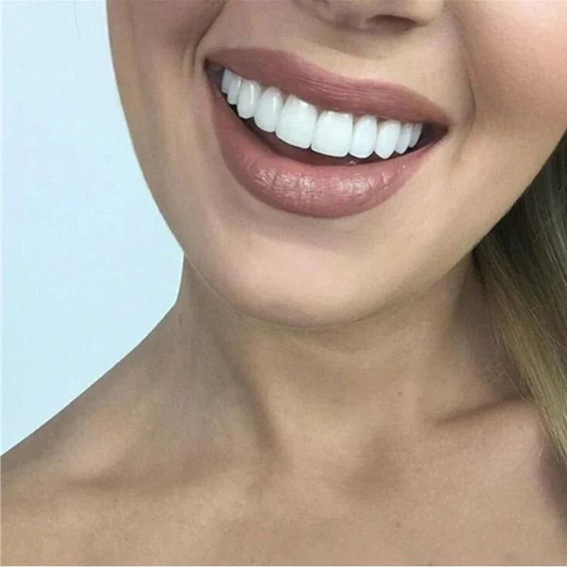 SnapFit Smile – Tandrestauratie voor een perfecte glimlach zonder bezoek aan de tandarts
