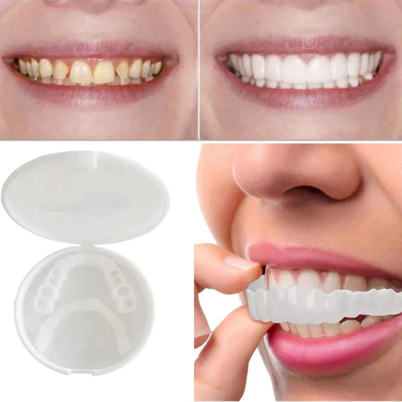 SnapFit Smile – Tandrestauratie voor een perfecte glimlach zonder bezoek aan de tandarts