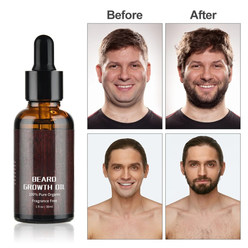 Bartboost - Kit de croissance de la barbe pour une barbe saine et vigoureuse