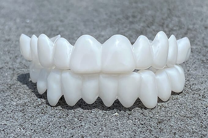SmileFlex – kunstgebit met witte dentale lenzen