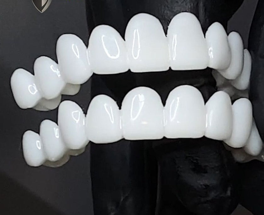 SmileFlex – kunstgebit met witte dentale lenzen