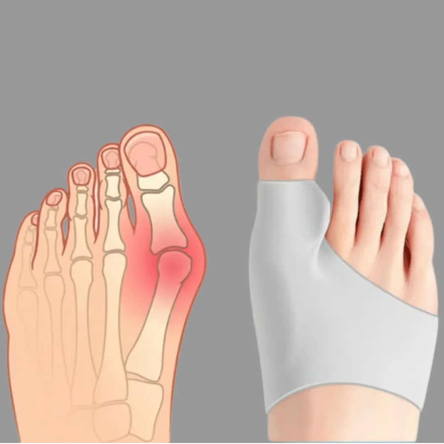 COMPRESSCARE TEEN – Hallux Valgus Corrector voor jongeren