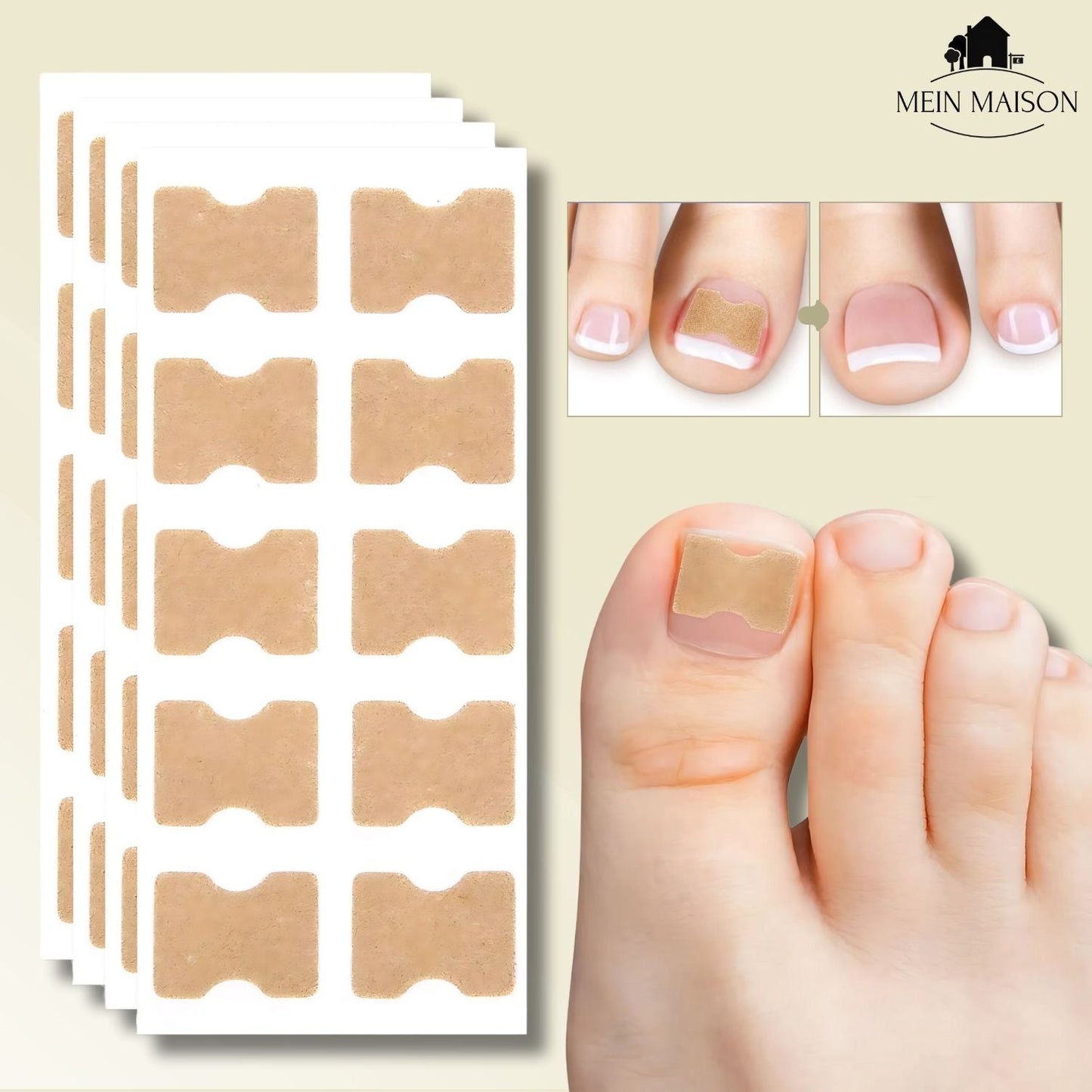 FixaNail – Corrección suave de uñas contra uñas encarnadas y dolor