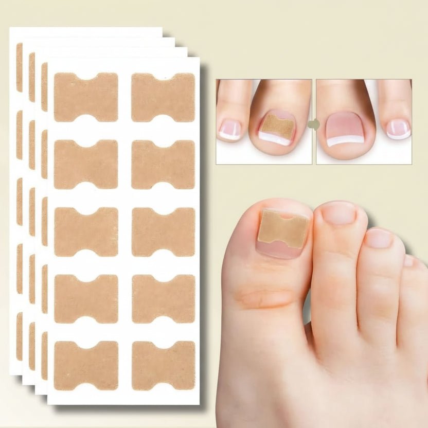 FixaNail - Correction en douceur des ongles incarnés et des douleurs