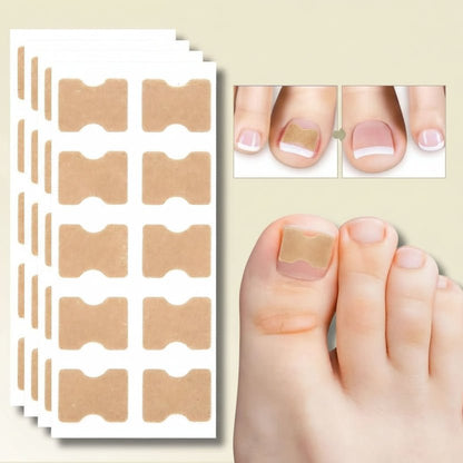 FixaNail - Correction en douceur des ongles incarnés et des douleurs