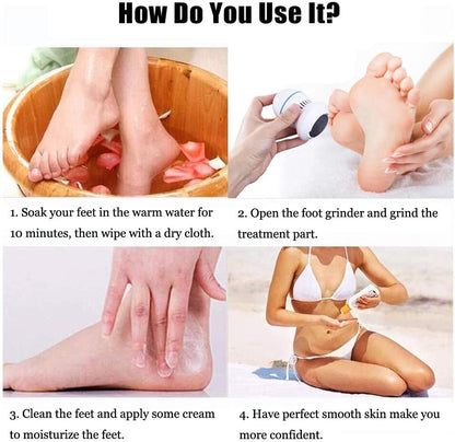 PEDIFEET – Dispositivo inalámbrico para el cuidado de los pies con función de vacío