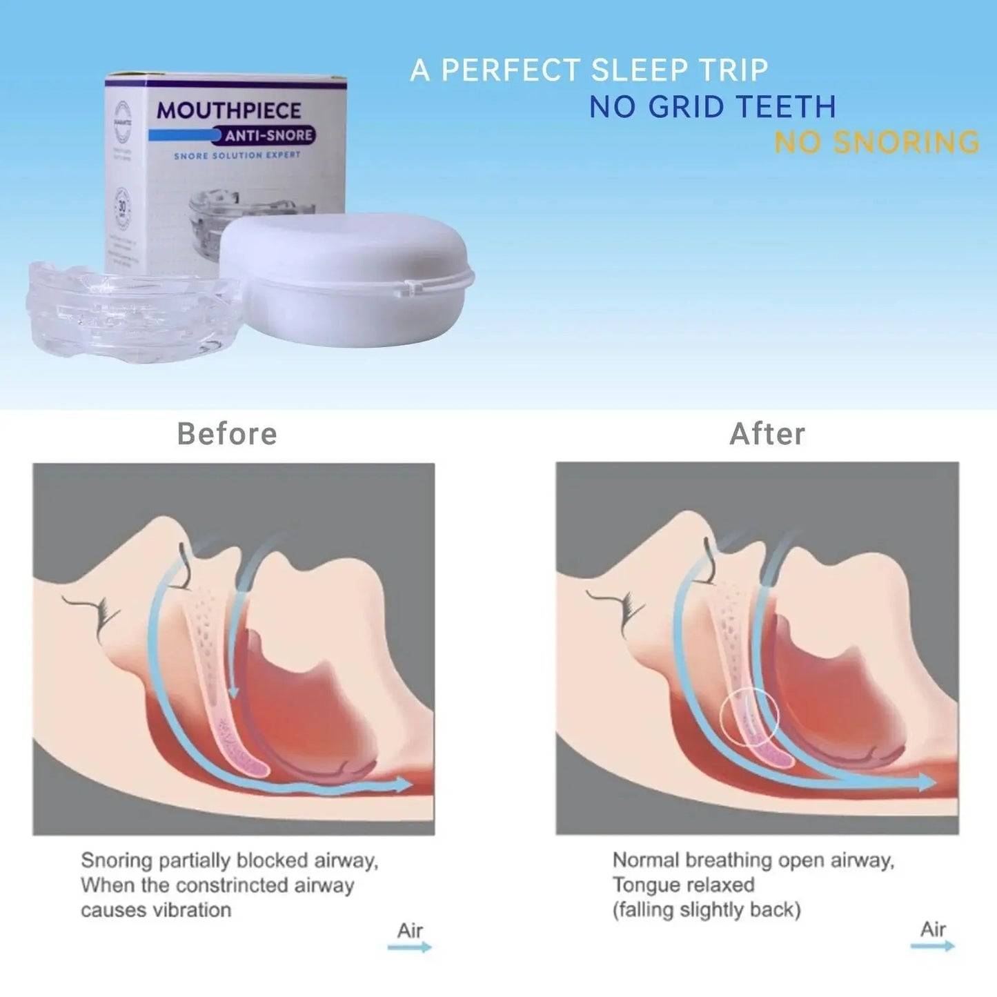SnoreFree PRO – Anti-Snurk Mondstuk tegen slaapapneu & snurken