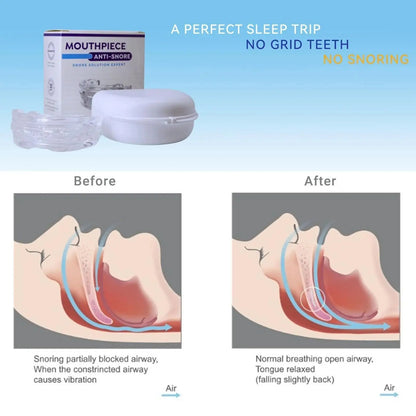 SnoreFree PRO – Anti-Snurk Mondstuk tegen slaapapneu & snurken