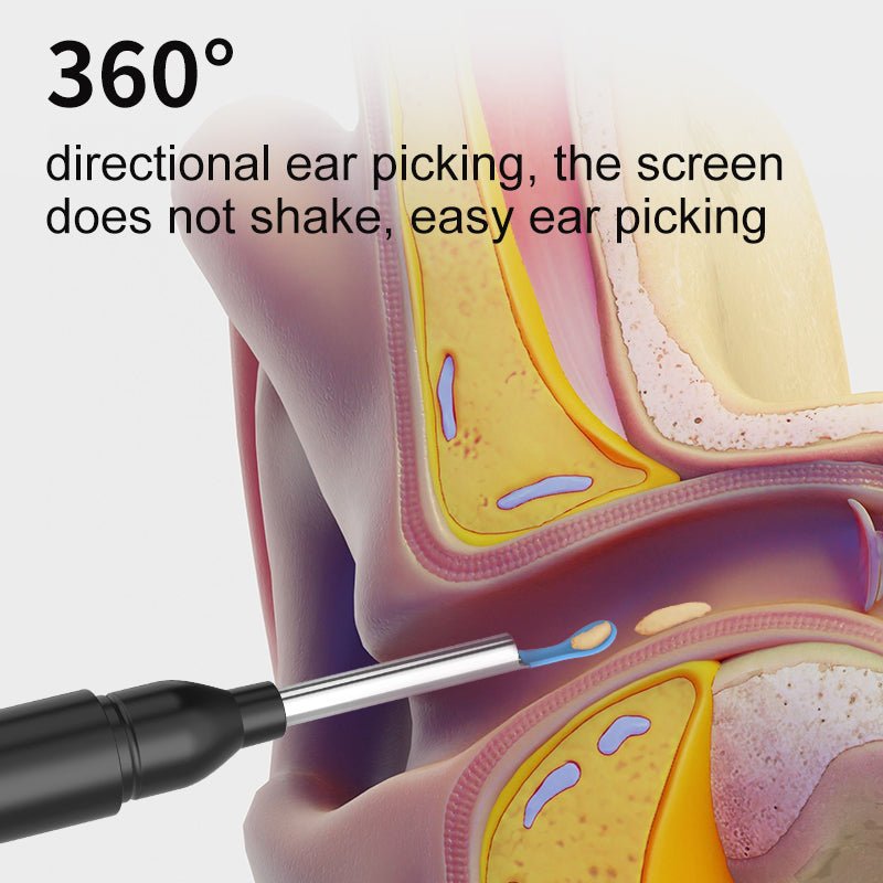 SmartView Mini – Compact tool for clear insights and precise observation
