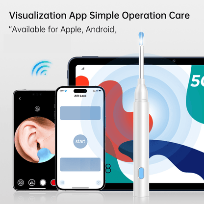 SmartView Mini – Compact tool for clear insights and precise observation
