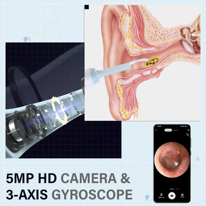 SmartView Mini – Compact tool for clear insights and precise observation