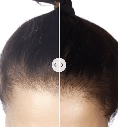 Multifunktionaler Haarkamm mit Lichttherapie - 5-in-1 Haarkamm für Gesundes Haar-4