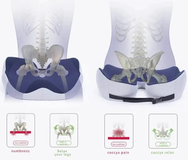 Ergocomfort Sitzkissen - Ergonomisches Stuhlkissen aus Memory-Schaum für Steißbeinunterstützung 7