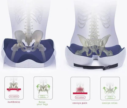 Ergocomfort Sitzkissen - Ergonomisches Stuhlkissen aus Memory-Schaum für Steißbeinunterstützung 7
