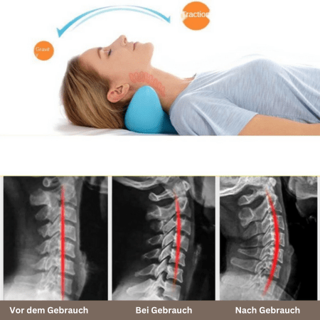 Tranquessence – Ergonomisches Nackenmassagekissen für Entspannung & Schmerzlinderung