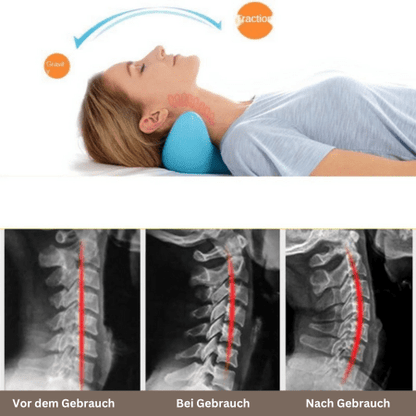 Tranquessence – Ergonomisches Nackenmassagekissen für Entspannung & Schmerzlinderung