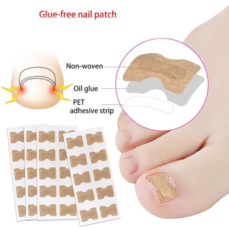 FixaNail - Correction en douceur des ongles incarnés et des douleurs