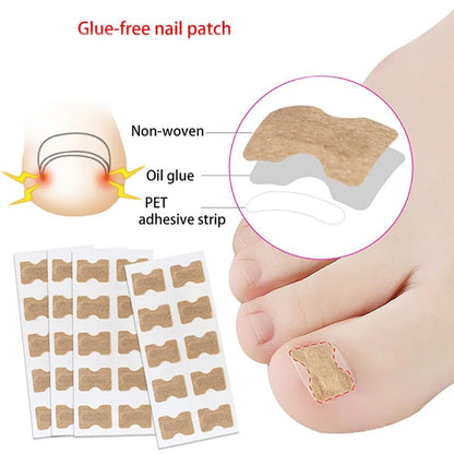 FixaNail - Correction en douceur des ongles incarnés et des douleurs