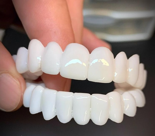 SmileFlex – kunstgebit met witte dentale lenzen