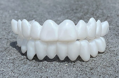SmileFlex – prothèse dentaire avec lentilles dentaires blanches