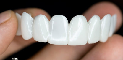 SmileFlex – prothèse dentaire avec lentilles dentaires blanches