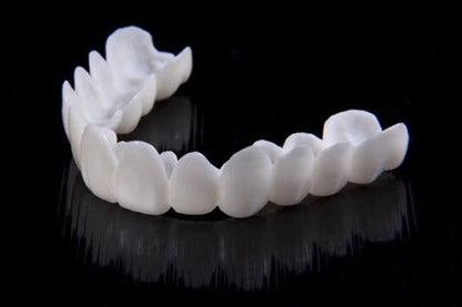 SmileFlex – prothèse dentaire avec lentilles dentaires blanches