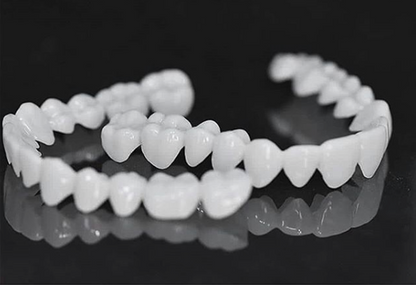 SmileFlex – prothèse dentaire avec lentilles dentaires blanches